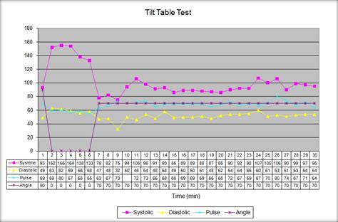 tilt test heart rate drop|tilt table blood test results.